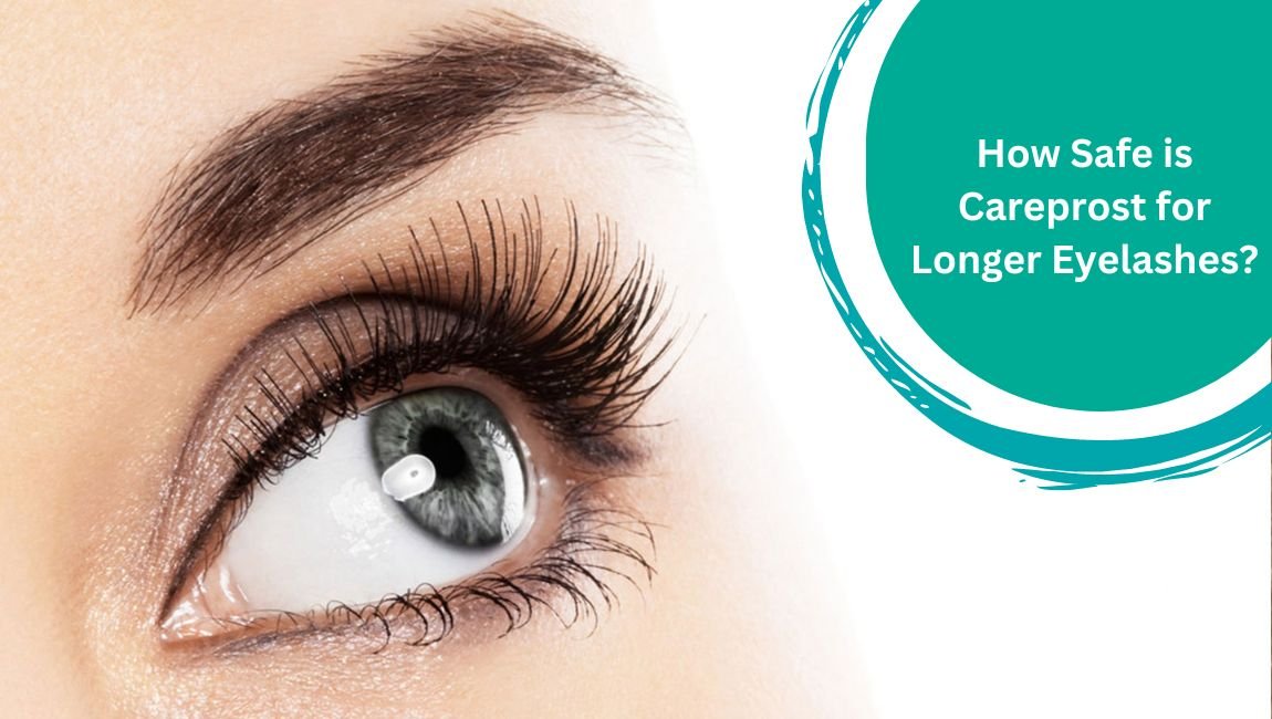 How Safe is Careprost for Longer Eyelashes?