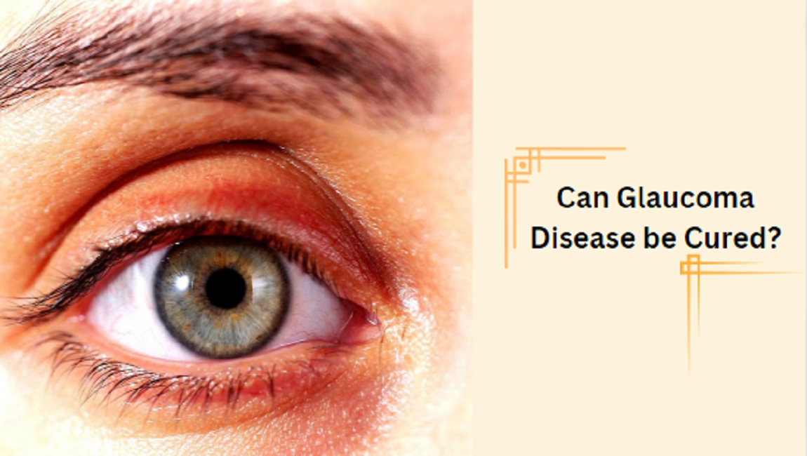 Can Glaucoma disease be cured